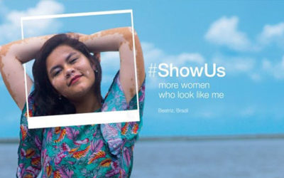 Dove #ShowUs Project